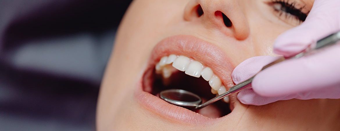 Tooth Implants Turkey